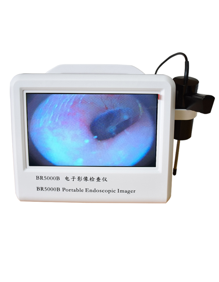 BR5000 型電子影像檢查儀